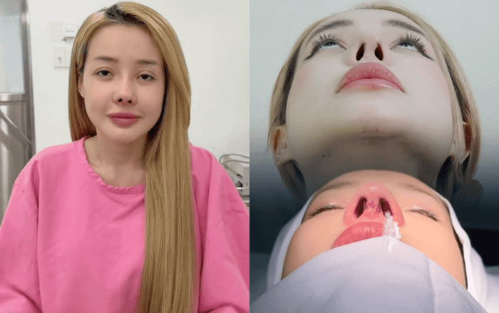 Showbiz 24h: Bác sĩ H., cho biết, Ngân 98 đang bị viêm ở trụ mũi nên cần thêm thời gian để điều trị (Ảnh: Chụp màn hình TikTok bác sĩ H.,)