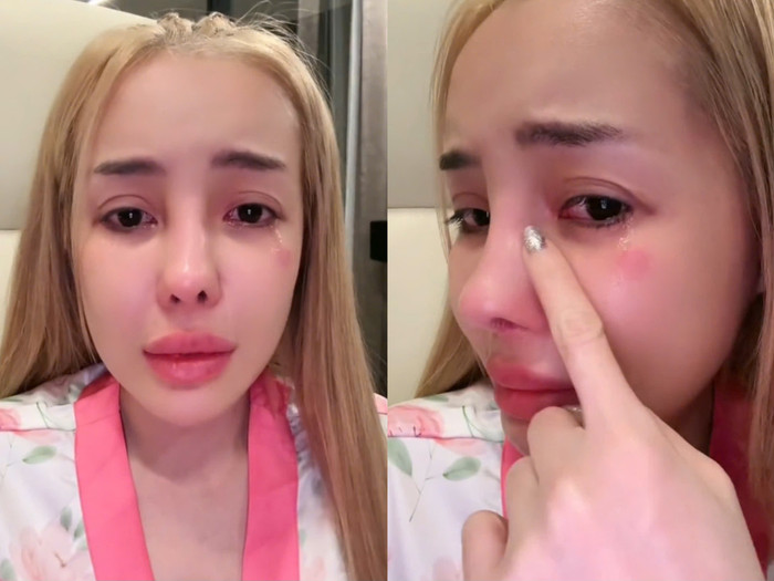 Ngân 98 bật khóc vì gương mặt sưng tấy, nguyên nhân do ăn hải sản quá nhiều.