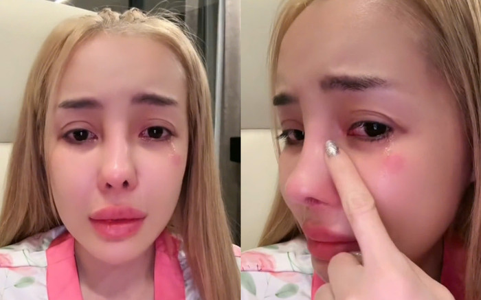 Ngân 98 bật khóc vì gương mặt sưng tấy Ảnh 2