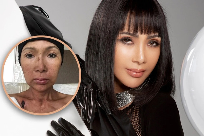 Từng là một ca sĩ kiêm người mẫu xinh đẹp, Zhang Mi đã bị căn bệnh ung thư tàn phá nhan sắc lẫn sức khỏe.