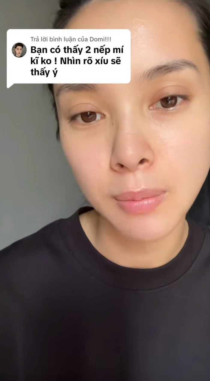 Quỳnh Lương phủ nhận tin đồn phẫu thuật thẩm mỹ. Ảnh: TikTok Quỳnh Lương