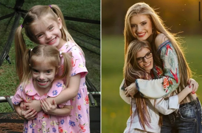 Hai chị em sinh đôi gây sốc với chiều cao chênh lệch 40cm.