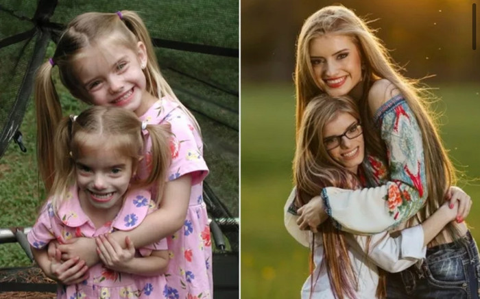 Cặp song sinh kỳ lạ: Chị cao 1m74, em chỉ 1m34 phá kỷ lục thế giới Ảnh 2