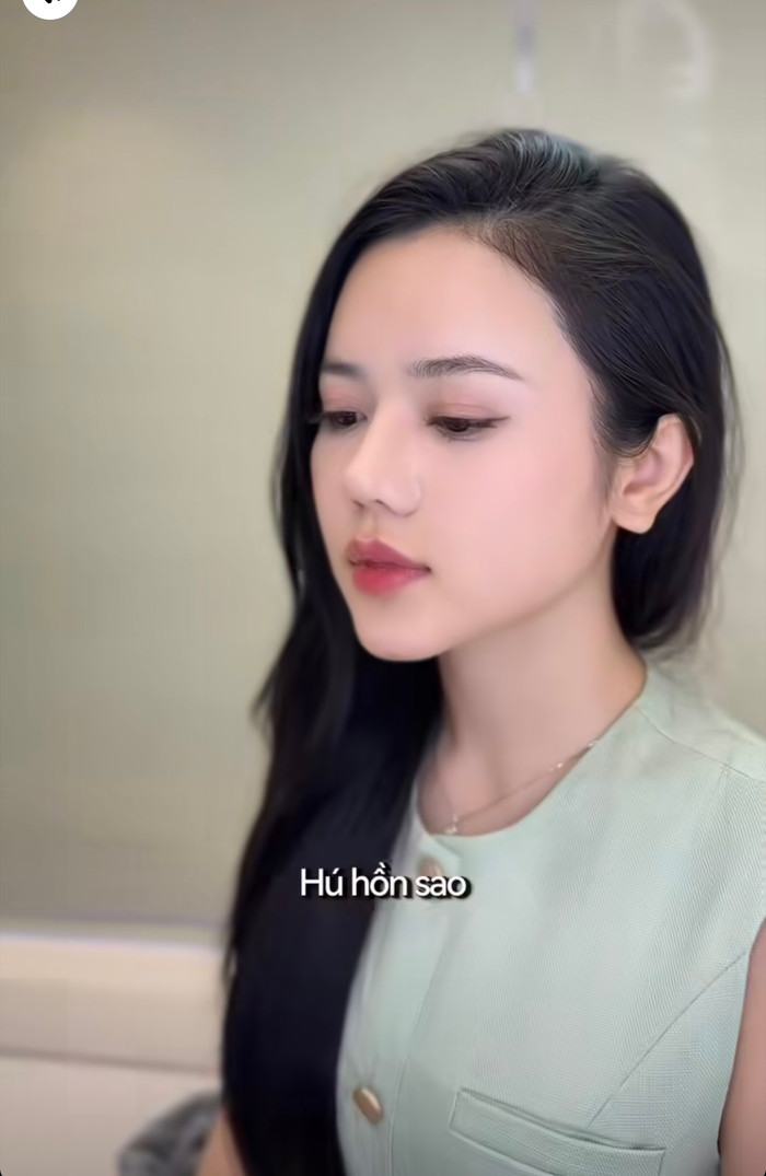 Ý Nhi tiêm filler gọn cằm. Ảnh: FBNV