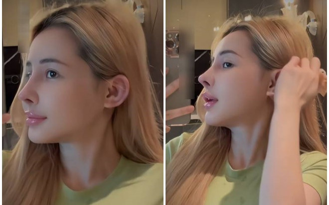 Ngân 98 khoe cận mũi mới sau 10 lần 'sửa sang' Ảnh 2