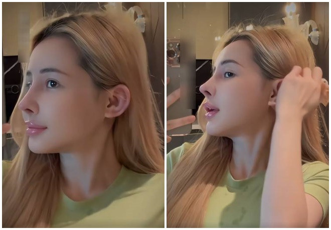 Ngân 98 khoe cận chiếc mũi sau lần 'sửa sang' thứ 10. (Ảnh chụp màn hình)