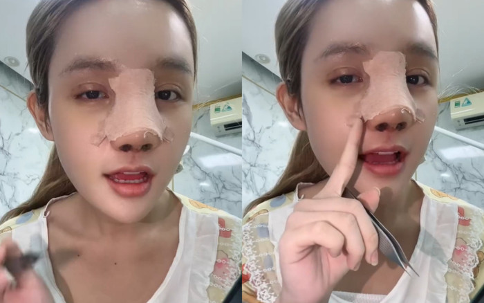 Em gái Ngân 98 sau 5 lần phẫu thuật thẩm mỹ Ảnh 2