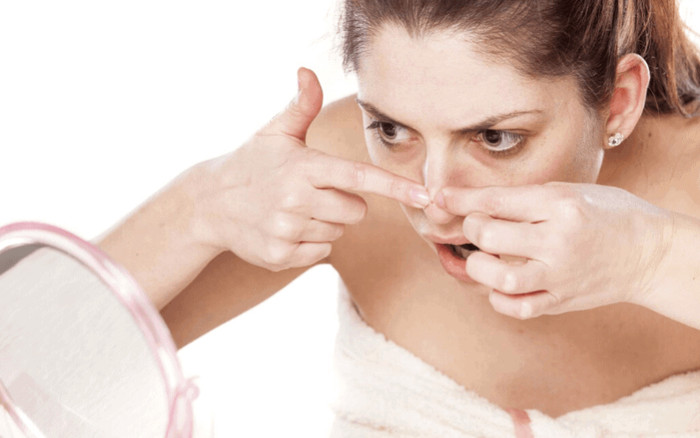 Những điều cần lưu ý khi bạn 'ngứa tay' muốn nặn mụn tại nhà Ảnh 2