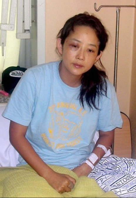 Những hình ảnh gây thương xót của nữ diễn viên Choi Jin Sil trước khi qua đời. 