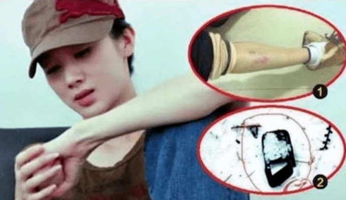 Nữ diễn viên bị đoàn làm phim đánh hội đồng nhập viện Ảnh 2
