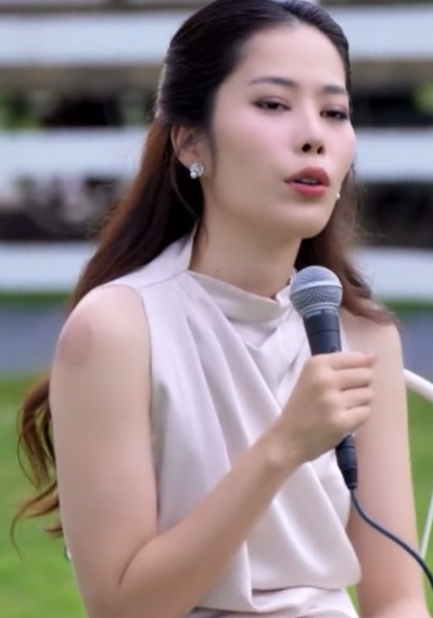 Dấu vết trên tay của Nam Em khiến cư dân mạng thắc mắc. 