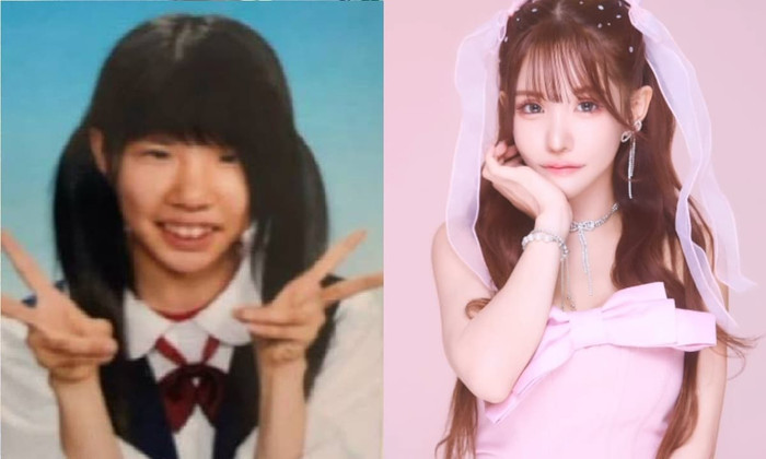 Airi Hirase đổi đời sau khi thẩm mỹ