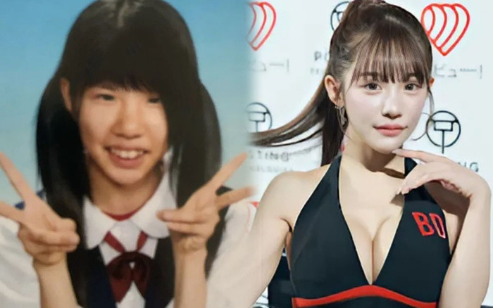 Bị chê giống đàn ông, sao nữ đổi đời sau khi chi 4 tỷ đồng phẫu thuật thẩm mỹ Ảnh 2