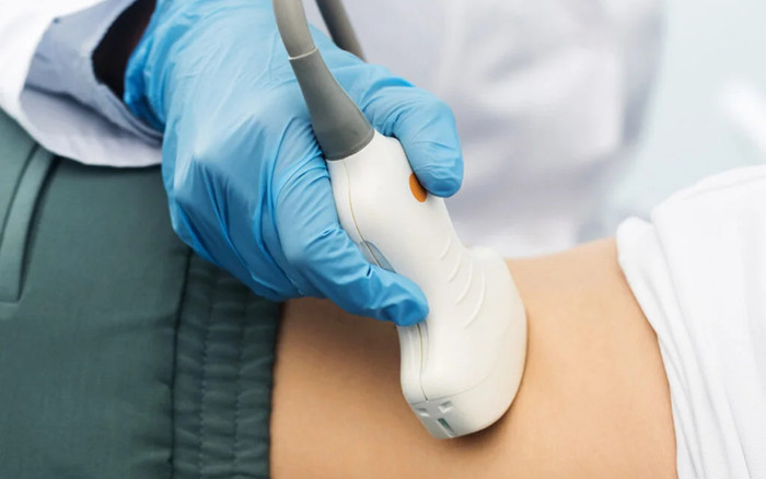 Người phụ nữ đau bụng suốt 18 năm sau khi sinh con, đi siêu âm thì phát hiện sự việc Ảnh 2