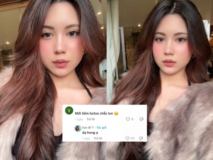 Hạt Dẻ - con gái Quyền Linh từ chối chuyện đã can thiệp tiêm thẩm mỹ.
