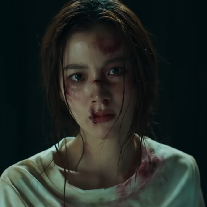 Nữ diễn viên Baifern Pimchanok bị đánh bầm dập