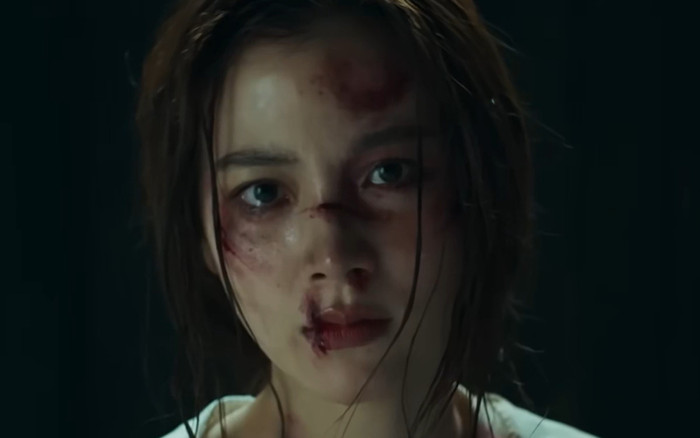 Không nhận ra nữ diễn viên xinh đẹp bậc nhất showbiz khi lộ diện với gương mặt bầm dập Ảnh 2