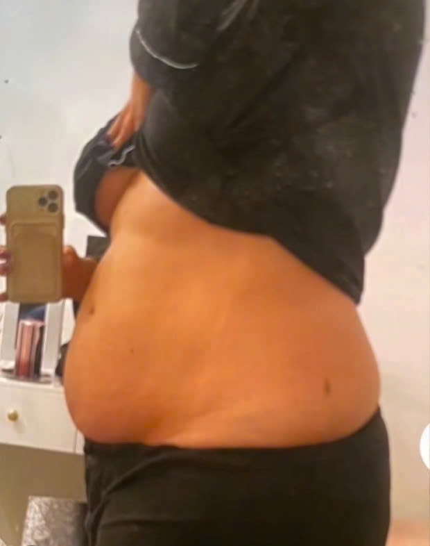 Cơ thể trước khi phẫu thuật của cô gái tên Lucy. 