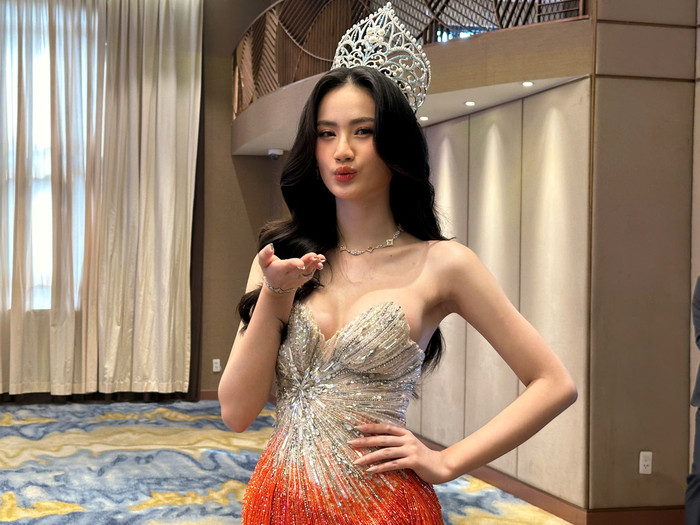Hoa hậu Ý Nhi phẫu thuật thẩm mỹ vào tháng 9/2023, thời điểm sau hai tháng cô nàng đăng quang Miss World Vietnam. 