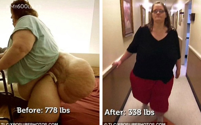 Người phụ nữ béo nhất thế giới, từng nặng 353kg giờ ra sao? Ảnh 2