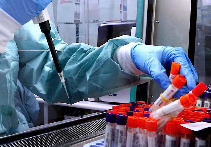 Australia làm thất lạc 300 lọ virus nguy hiểm chết người. Ảnh minh hoạ: NewsWire