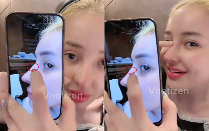 Showbiz 24h: Ngân 98 lo lắng vì một số dấu hiệu bất ổn trên chiếc mũi mới. Ảnh: Chụp màn hình từ TikTok Vnetizen