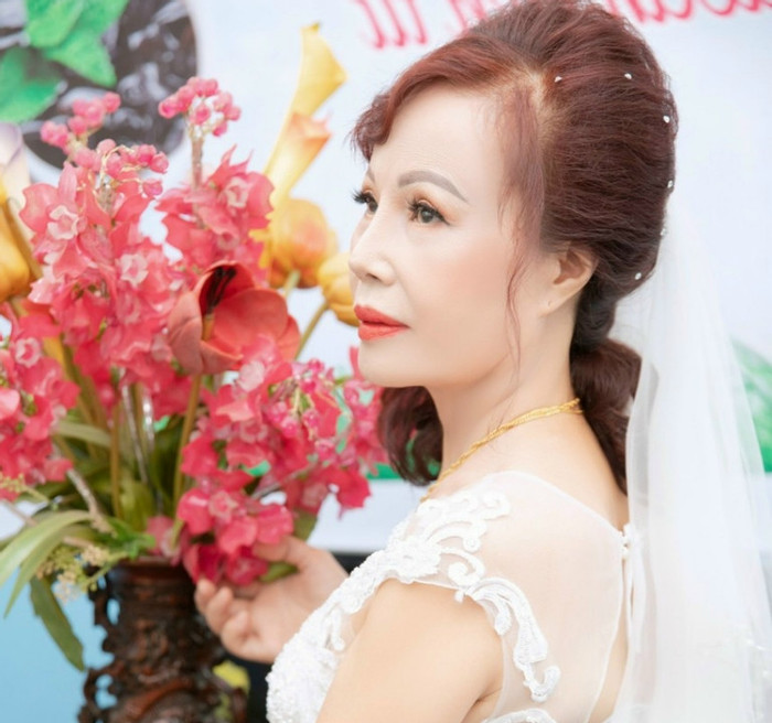 Cô dâu Thu Sao đã trải qua nhiều cuộc thẩm mỹ để có nhan sắc xinh đẹp và trẻ trung hơn