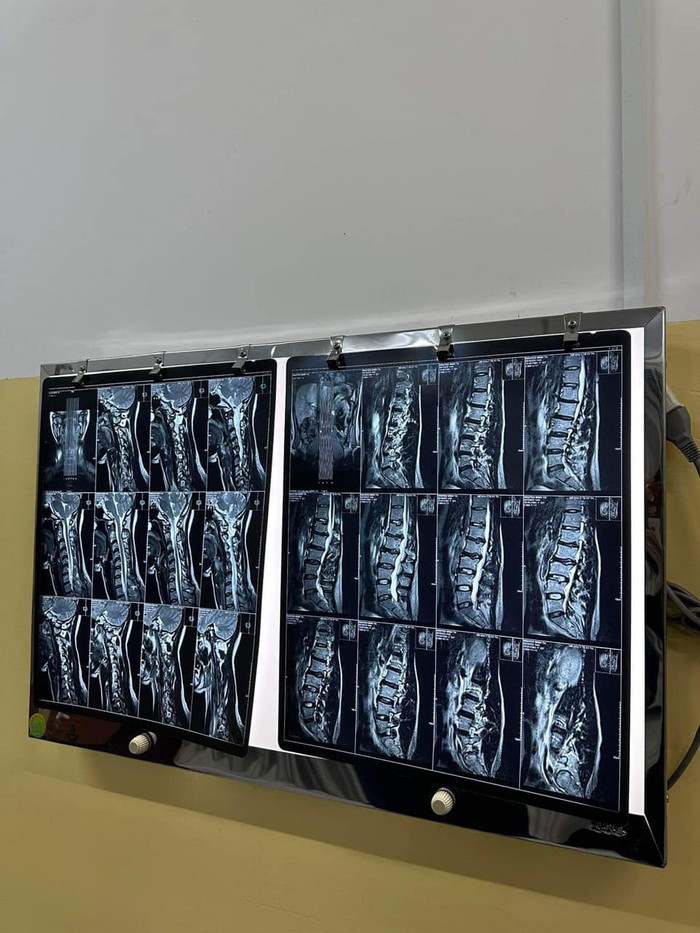 Tình trạng sức khỏe đáng báo động của siêu mẫu Minh Tú Ảnh 2