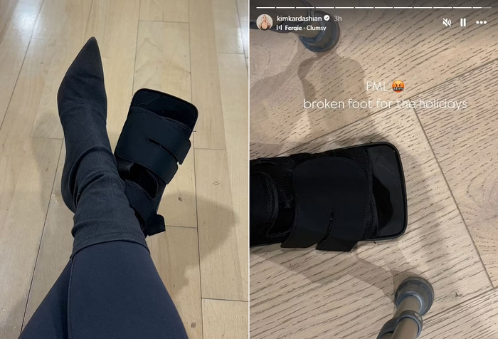 Kim Kardashian bị gãy chân có thể bắt nguồn từ việc gặp sự cố khi tham gia các hoạt động thể thao ngoài trời.