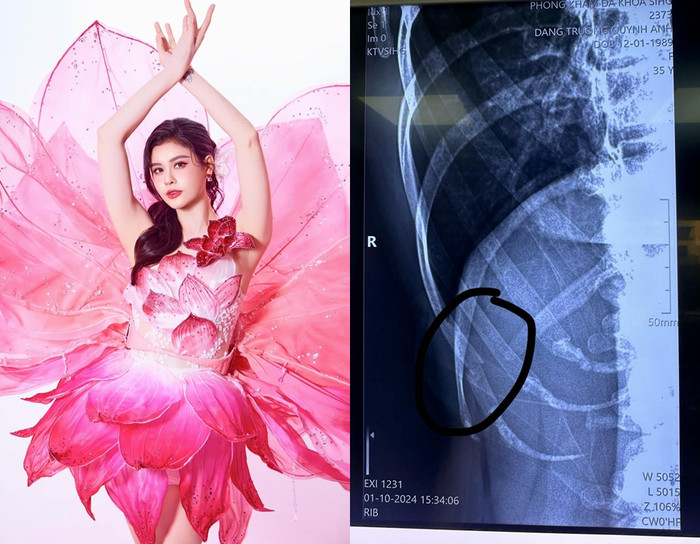 Nữ ca sĩ dừng cuộc chơi vì chấn thương. Cô rất tiếc nuối vì bản thân vô cùng yêu thích dancesport cũng như được đánh giá cao tại chương trình năm nay. (Ảnh: FB Lương Trọng Nghĩa)