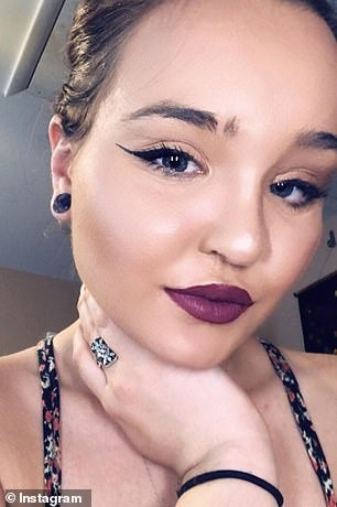 Diện mạo hiện tại của người mẫu Nicole Sincavage sau khi trải qua 16 lần phẫu thuật.