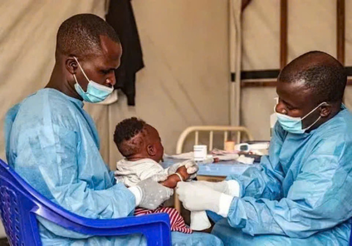 Bệnh lạ ở Congo khiến nhiều người mắc và tử vong. Ảnh minh họa