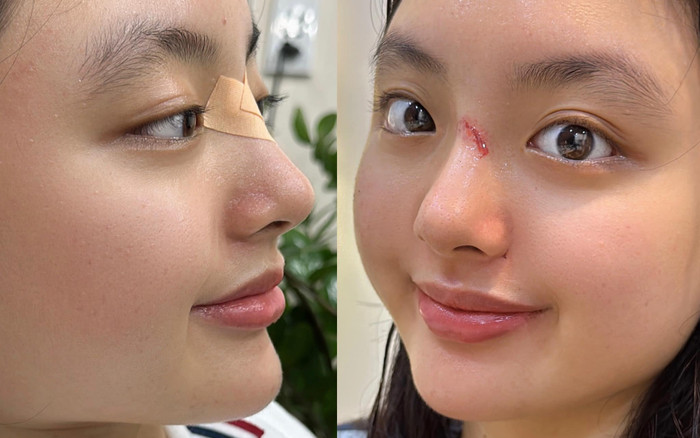 Ái nữ nhà Thuý Hạnh gặp sự cố Ảnh 2