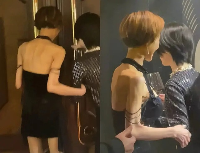 Năm ngoái, hình ảnh của ngôi sao phim Sex and Zen khiến nhiều người lo lắng vì gầy quá mức.&nbsp;