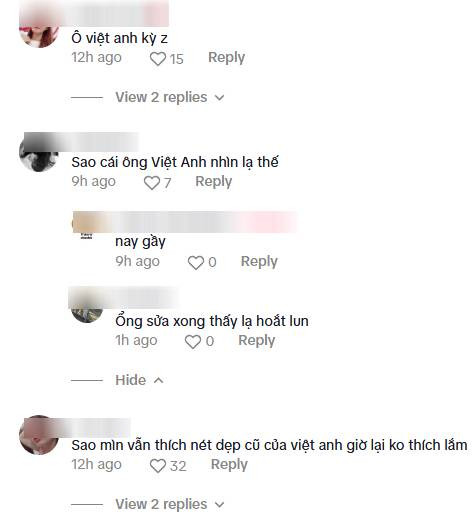 Vẻ ngoài khác lạ của Việt Anh khiến dân tình xôn xao bàn tán. (Ảnh chụp màn hình)