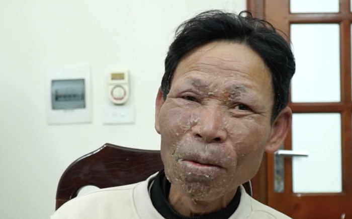 Video: Lời khai với tình tiết bất ngờ của kẻ đốt quán hát khiến 11 người tử vong Ảnh 2