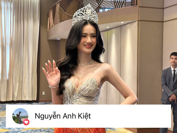 Phản ứng của bạn trai Ý Nhi về việc bạn gái phẫu thuật thẩm mỹ gây chú ý.