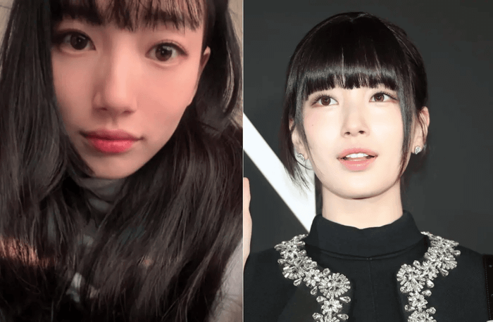 Cư dân mạng còn ghép hai ảnh của Suzy trước và sau khi phẫu thuật lấy nốt ruồi kết mạc ở mắt để so sánh. Ảnh: Sưu tầm