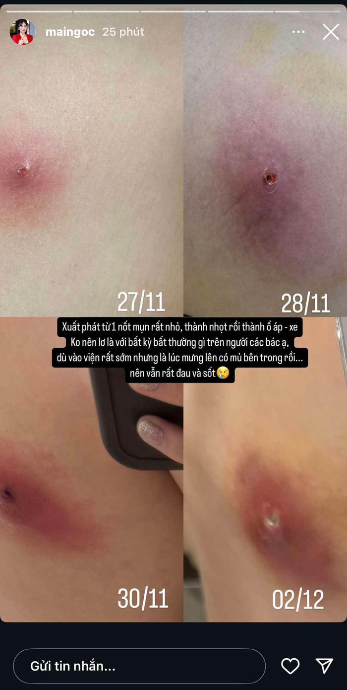 Mai Ngọc cảnh báo đến mọi người. Tình trạng sức khoẻ của nữ MC dạo gần đây khiến nhiều người lo lắng. Ảnh: Instagram Mai Ngọc