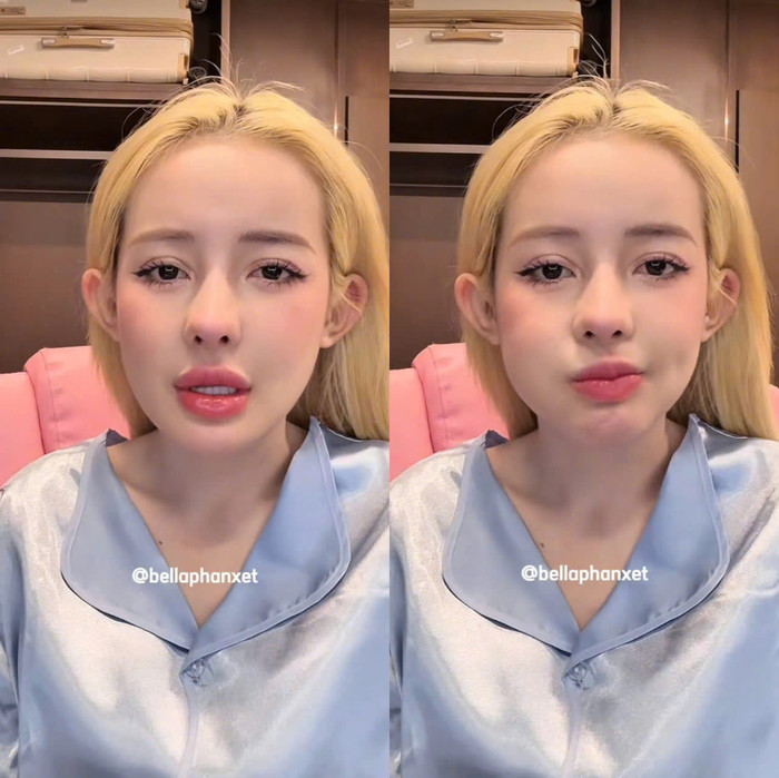 Ngân 98 tiếc nuối không muốn tháo sụn mũi vì cô rất ưng chiếc mũi hiện tại. Ảnh: Chụp màn hình Tiktok Bellaphanxet)