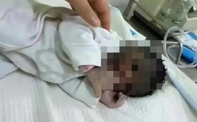 Chuyên gia cho biết màu da của trẻ sơ sinh thường tối màu khi mới chào đời và sẽ thay đổi theo thời gian.