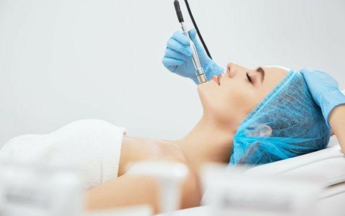 Những điều cần biết trước khi bắt đầu lăn kim tại nhà Ảnh 2