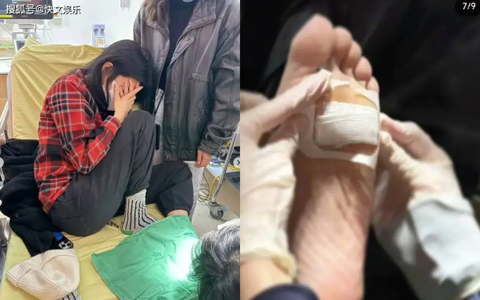 Nữ diễn viên Dương Kim Hoa công bố hình ảnh khi đi viện để xử lý vết thương, và phải băng bó chân trong những ngày sau đó. Ảnh: Sưu tầm