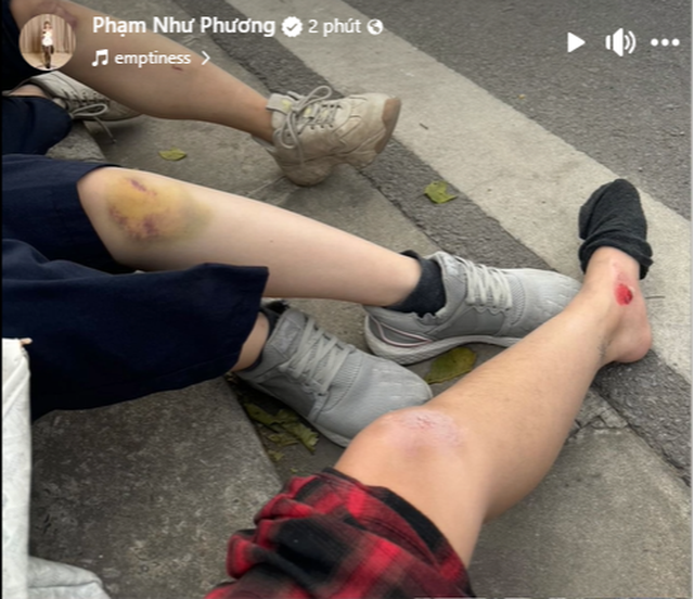 Louis Phạm chia sẻ trên trang cá nhân của mình.