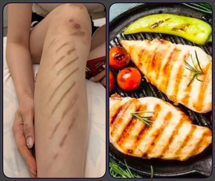 Trấn Thành chia sẻ về chấn thương của Hari Won. (Ảnh FBNV)