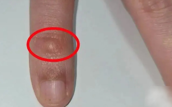 Tưởng mắc bệnh tình dục, người đàn ông ngỡ ngàng vì thói quen xấu từ chiếc điện thoại Ảnh 2