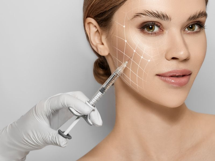 Nên căng da mặt hay tiêm filler để níu kéo 'tuổi xuân'? Ảnh 3