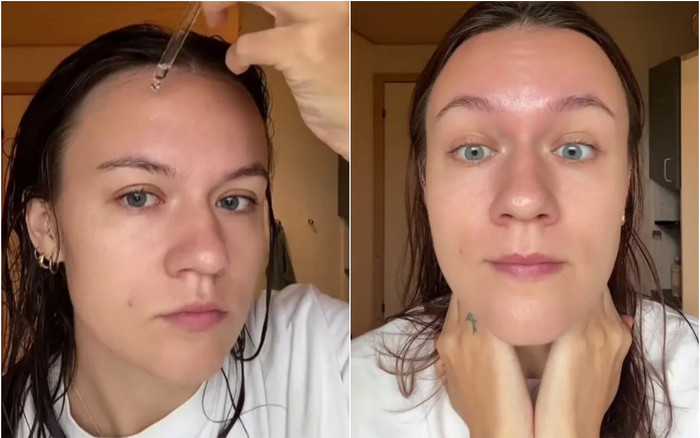 Huyết thanh giá rẻ được đánh giá cao hơn cả Botox Ảnh 2