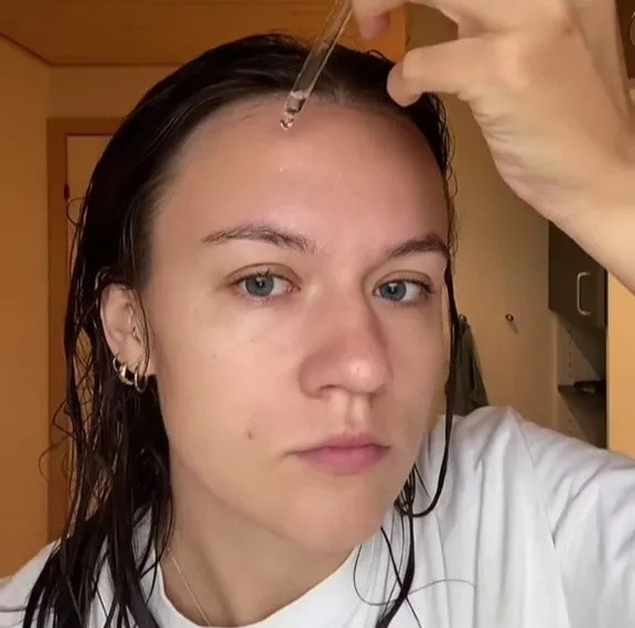 Hot Tiktoker - Martine chia sẻ về loại huyết thanh 'tốt hơn cả botox'.