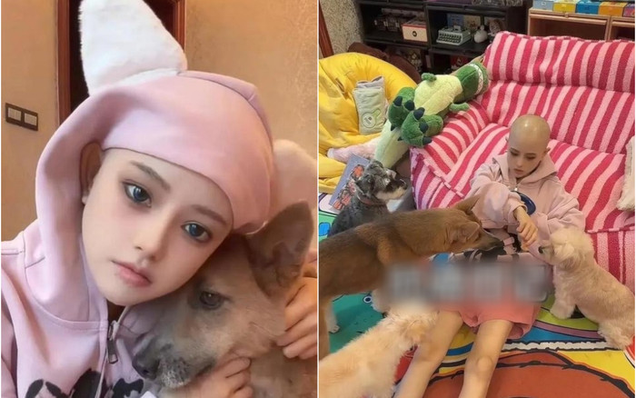 TikToker nổi tiếng qua đời ở tuổi 29 vì ung thư trực tràng, lý do khiến ai cũng xót xa Ảnh 2